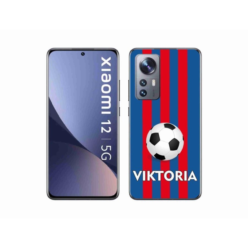 Gél borítás mmCase a Xiaomi 12X készülékhez - Viktoria