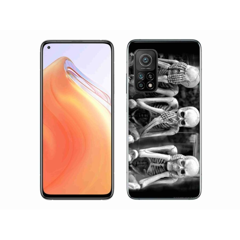 Gél borítás mmCase a Xiaomi Mi 10T Pro 5G számára - csontvázak