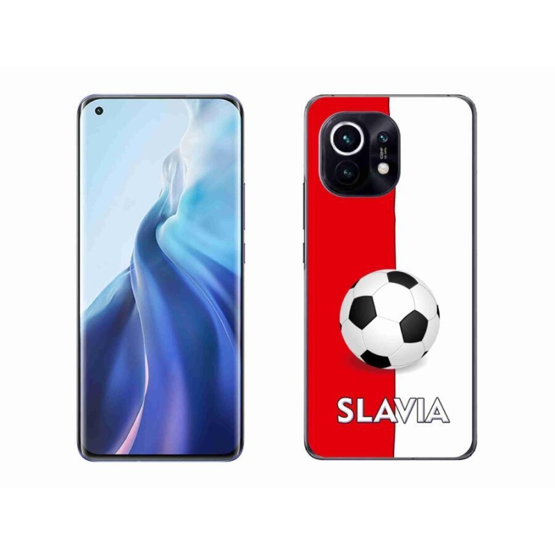 Gél borítás mmCase a Xiaomi Mi 11-hez - futball 2