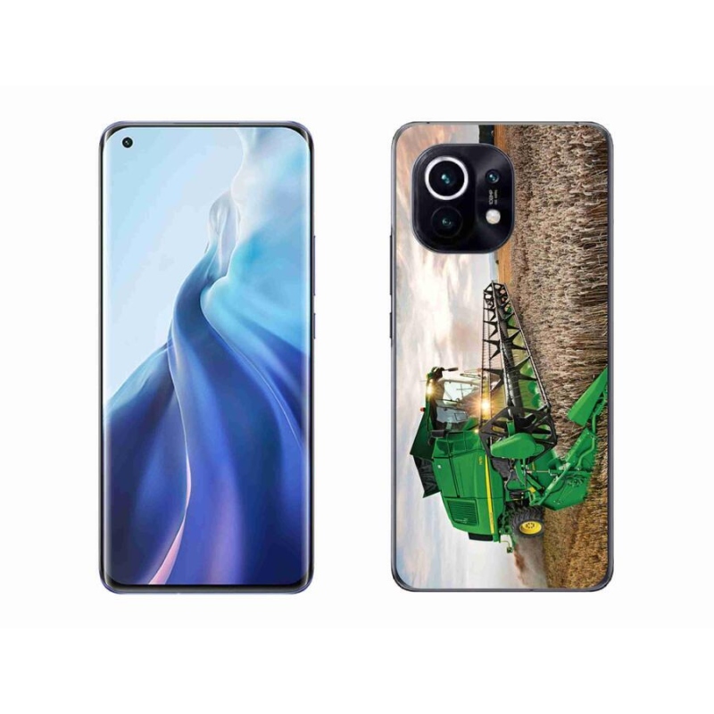 Gél borítás mmCase a Xiaomi Mi 11-hez - kombinálni