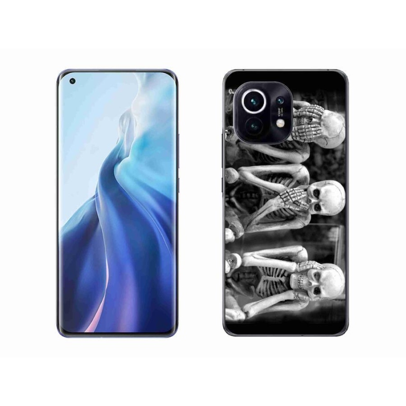 Gél borító mmCase a Xiaomi Mi 11-hez - csontvázak