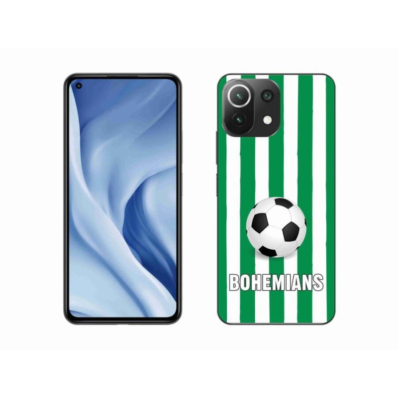 Gél borítás mmCase a Xiaomi Mi 11 Lite 4G/5G-hez - Bohemians