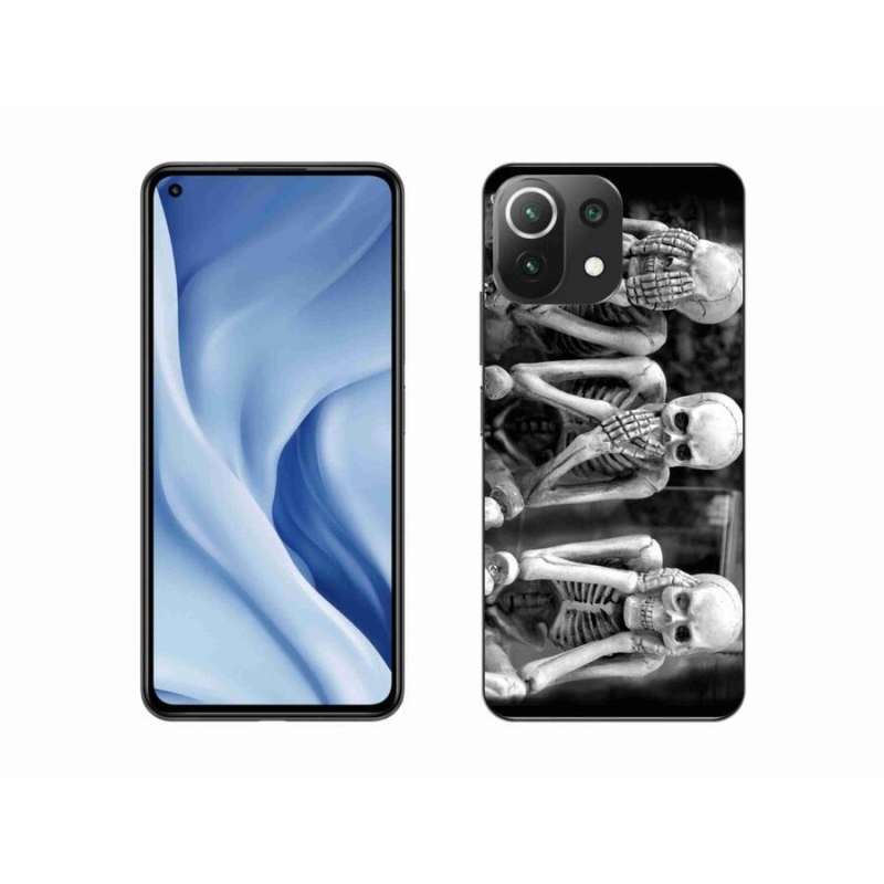 Gél borítás mmCase a Xiaomi Mi 11 Lite 4G/5G-hez - csontvázak