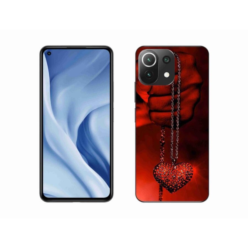 Gél borítás mmCase a Xiaomi Mi 11 Lite 4G/5G-hez - nyaklánc