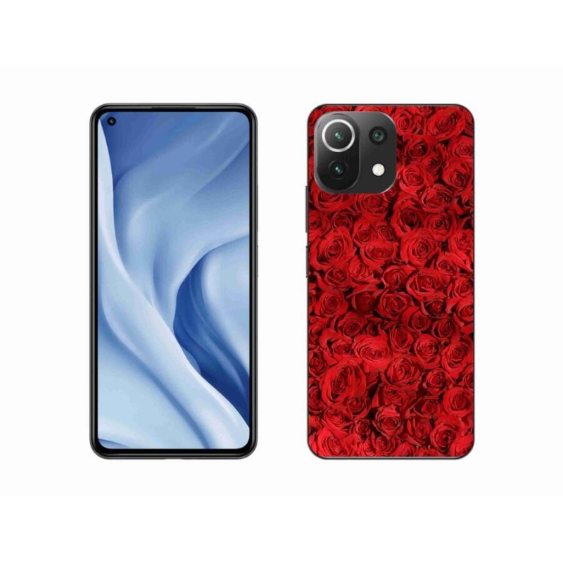 Gél borítás mmCase a Xiaomi Mi 11 Lite 4G/5G-hez - rózsaszínű