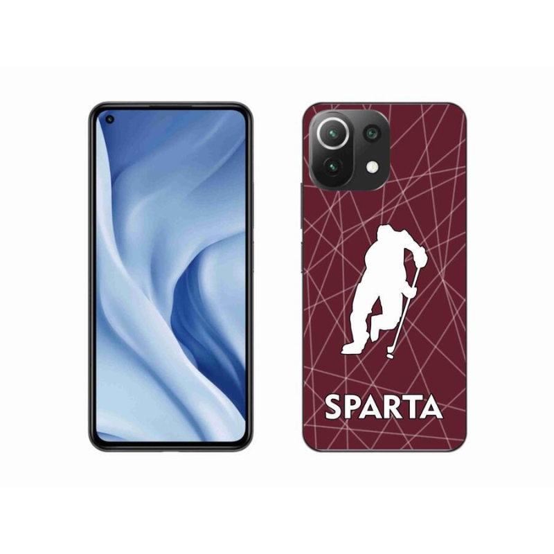 Gél borítás mmCase a Xiaomi Mi 11 Lite 4G/5G készülékhez - Sparta