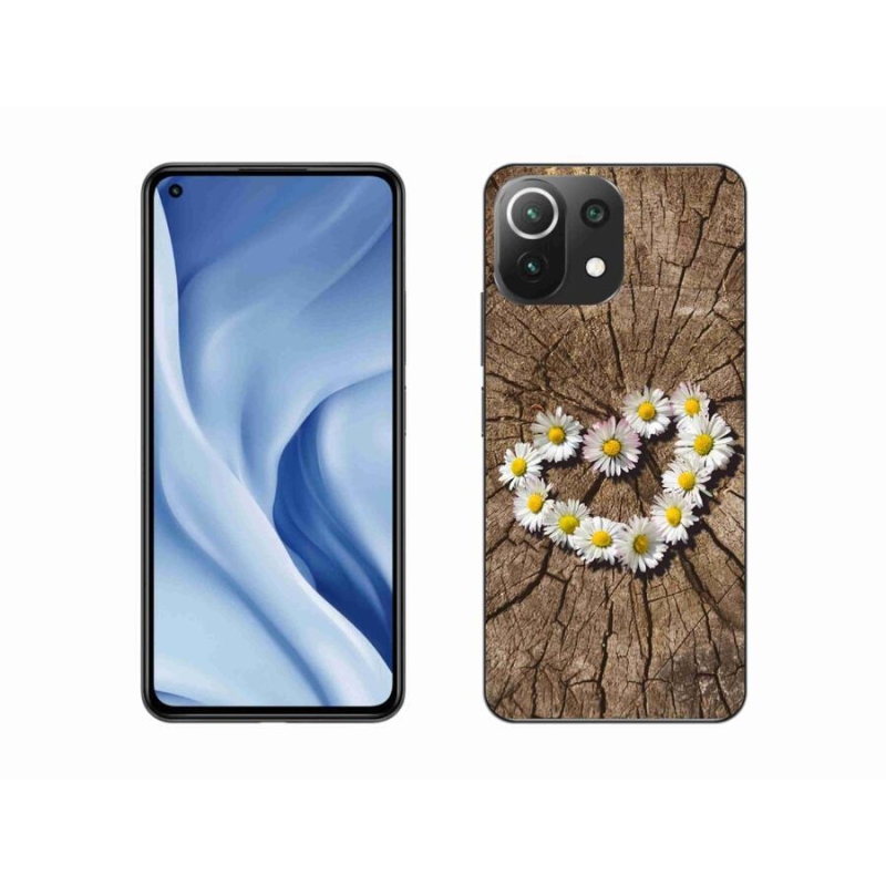 Gél borítás mmCase a Xiaomi Mi 11 Lite 4G/5G-hez - százszorszépek szíve