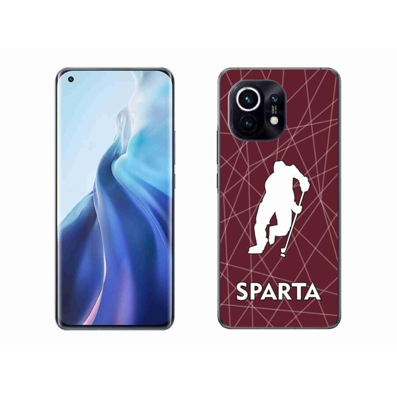 Gél borítás mmCase a Xiaomi Mi 11-hez - Sparta
