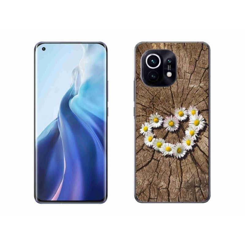 Gél borítás mmCase a Xiaomi Mi 11-hez - százszorszépek szíve