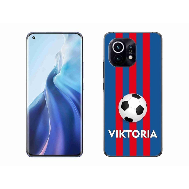Gél borítás mmCase a Xiaomi Mi 11-hez - Viktoria