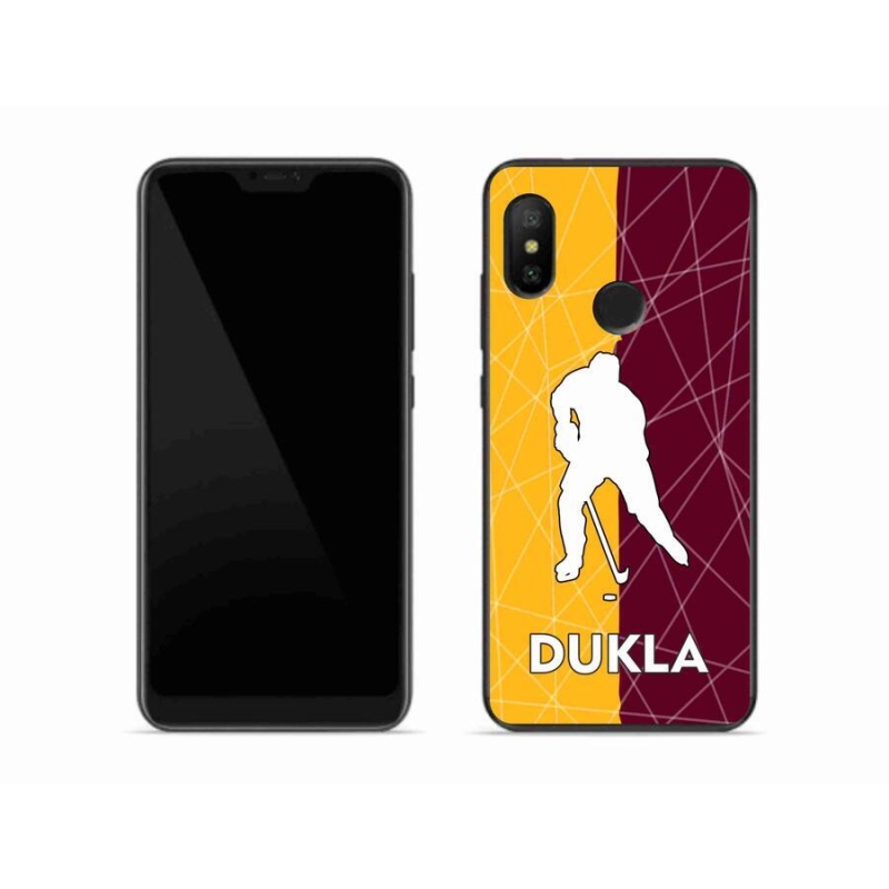 Gél borítás mmCase a Xiaomi Mi A2 Lite készülékhez - Dukla