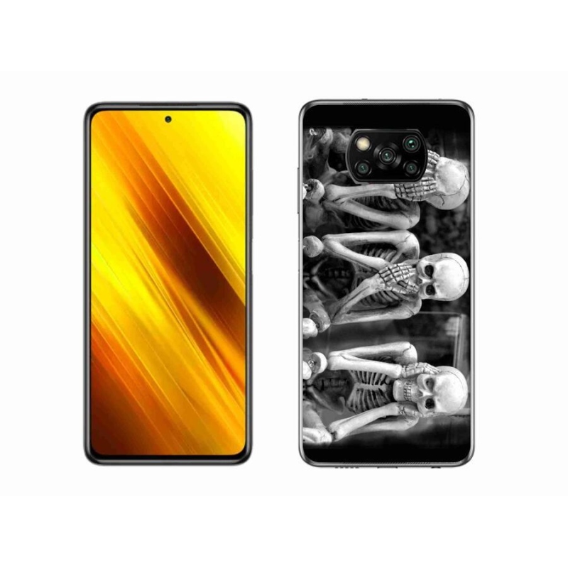 Gél borítás mmCase a Xiaomi Poco X3-hoz - csontvázak
