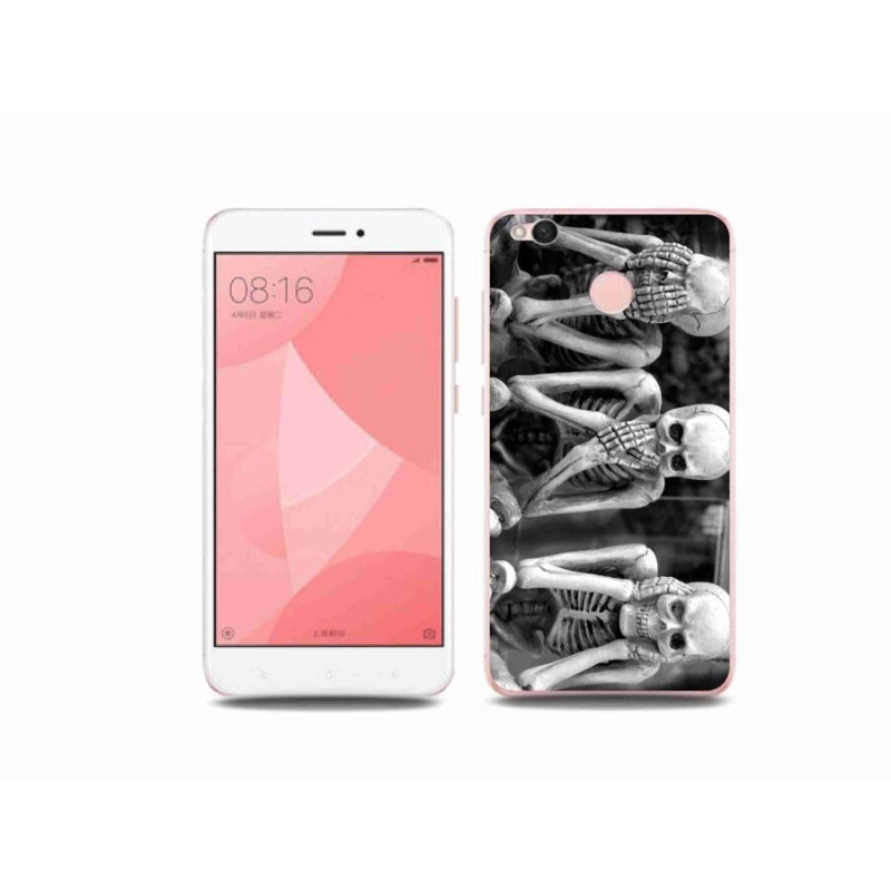 Gél borítás mmCase a Xiaomi Redmi 4X-hez - csontvázak