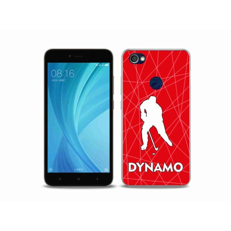 Gél borítás mmCase a Xiaomi Redmi Note 5A Prime készülékhez - Dynamo 2