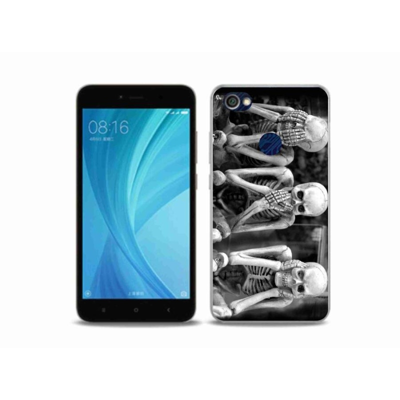 Gél borítás mmCase a Xiaomi Redmi Note 5A Prime számára - csontvázak