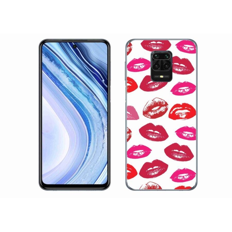 Gél borítás mmCase a Xiaomi Redmi Note 9S-hez - ajkak