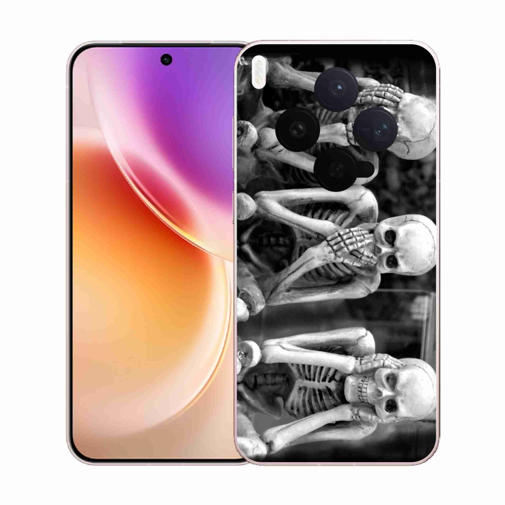 Zselés borítás mmCase Vivo X300-hoz - csontvázak