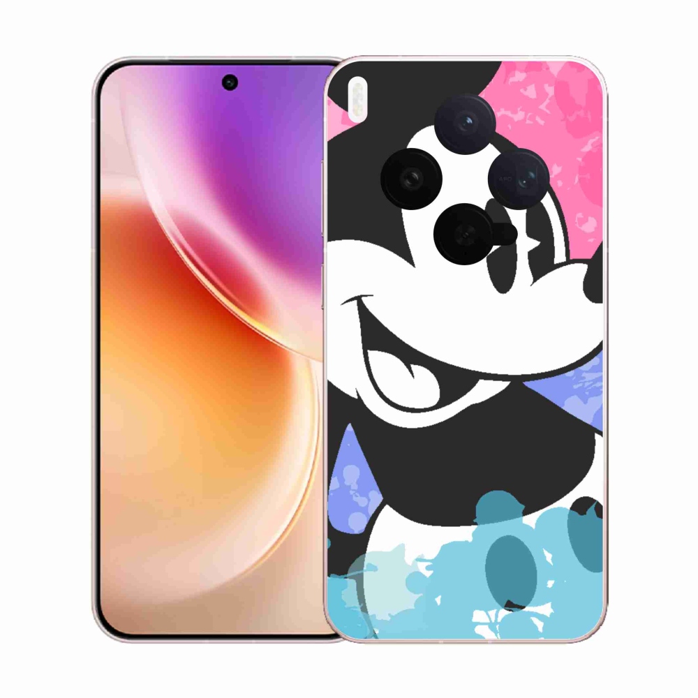 Zselés borítás mmCase Vivo X300-hoz - mickey egér