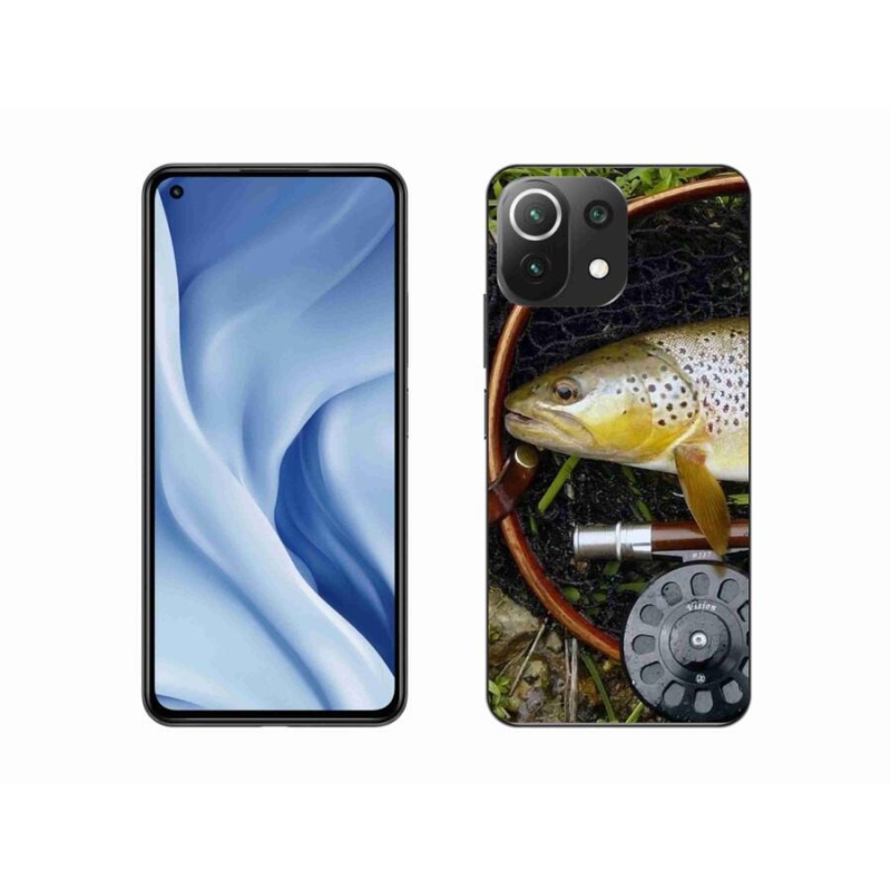 Gél tok mmCase a Xiaomi Mi 11 Lite 4G/5G-hez - 2. trófea