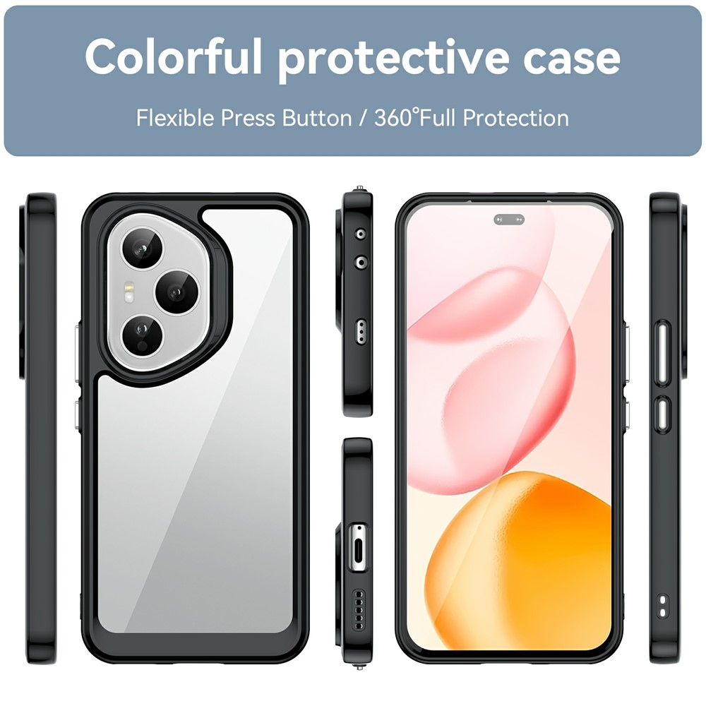 Gél tok fix hátlappal Honor 400 Pro-hoz - fekete