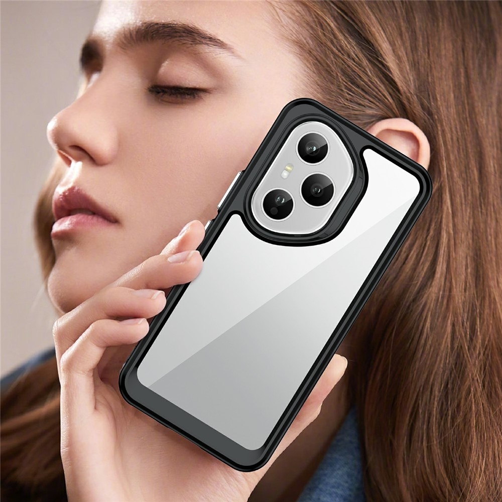 Gél tok fix hátlappal Honor 400 Pro-hoz - fekete