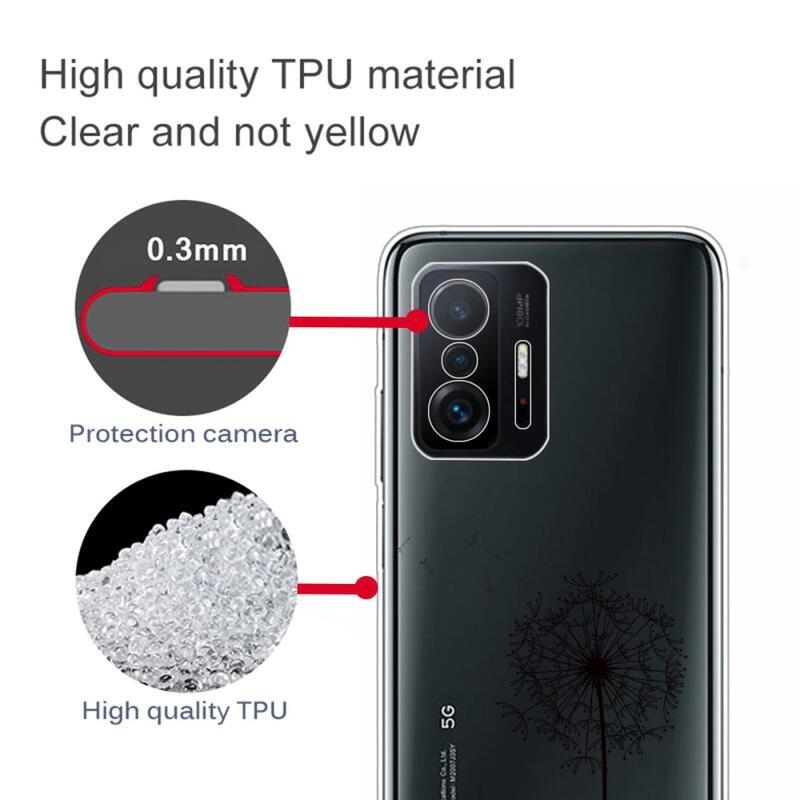 IMD zselés tok Xiaomi 11T/11T Pro - pitypang