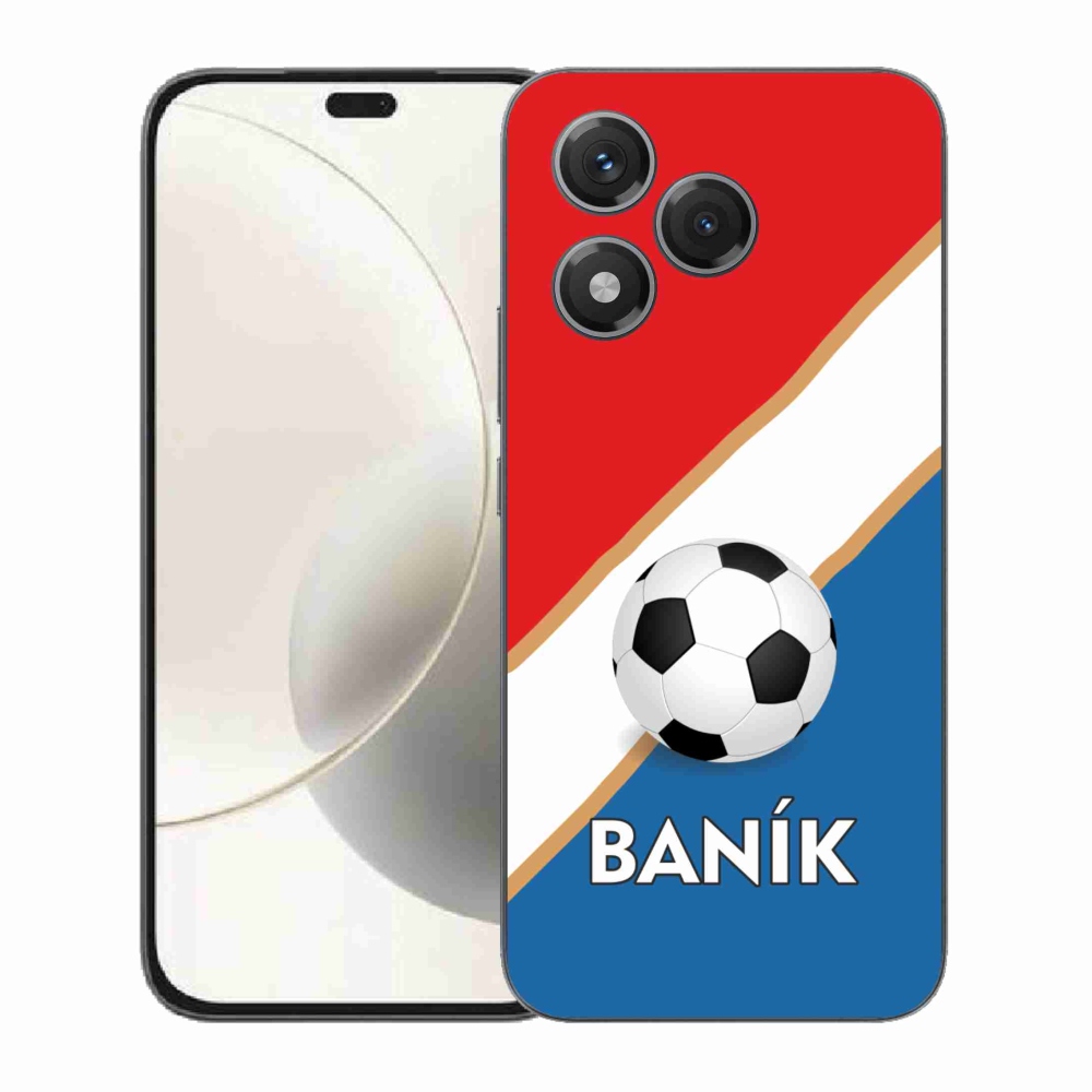 Zselés borítás mmCase a Honor 400 Lite-hoz - Baník