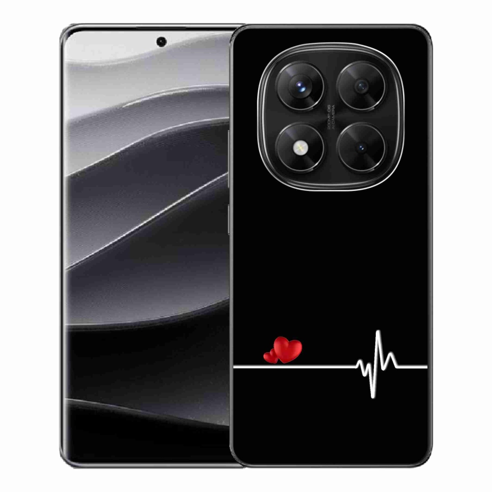 Gél borítás mmCase a Xiaomi Redmi Note 14 Pro 5G/Poco X7 5G számára - szív és szívverés fekete háttérrel