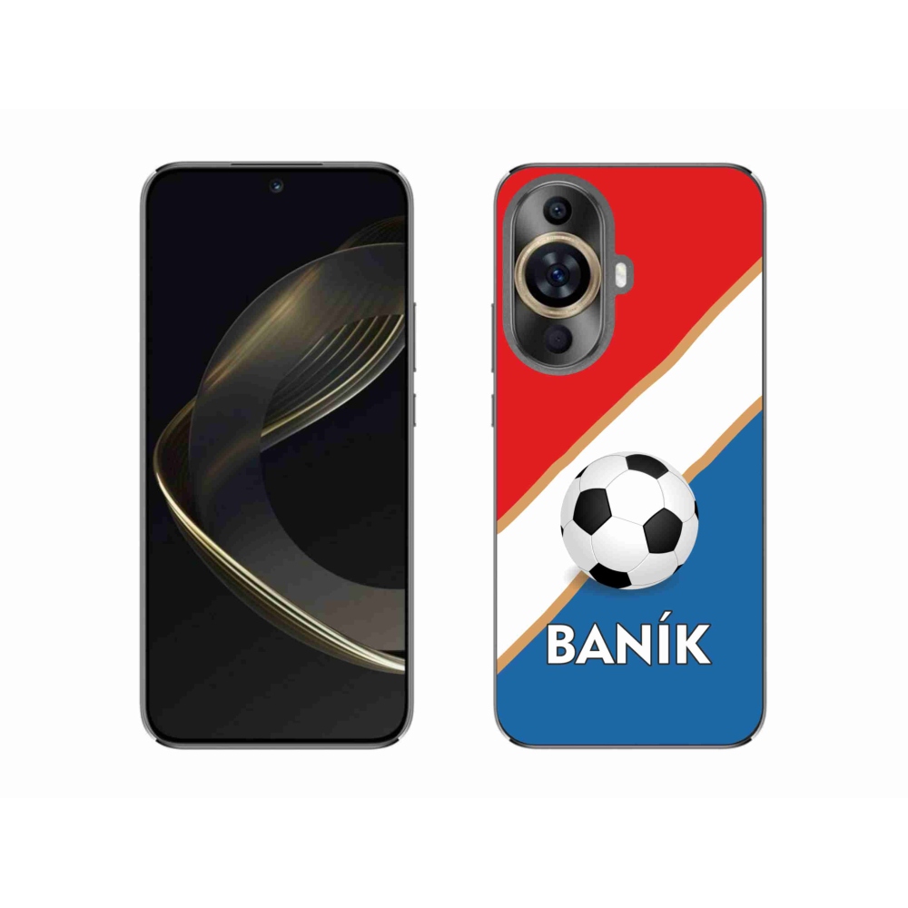 Gél borítás mmCase a Huawei Nova 11 készülékre - Baník