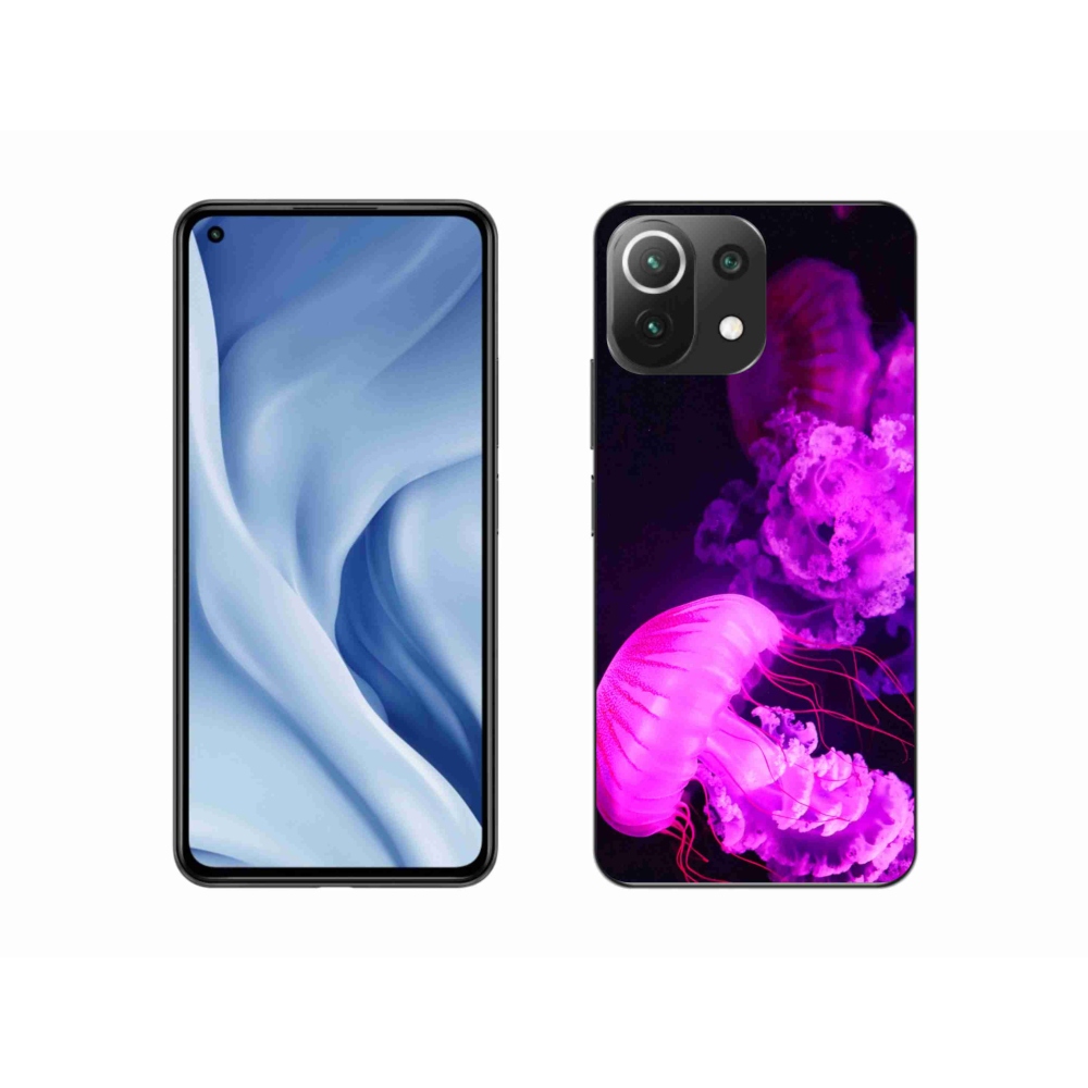 Gél borítás mmCase a Xiaomi Mi 11 Lite 4G/5G-hez - medúza 1