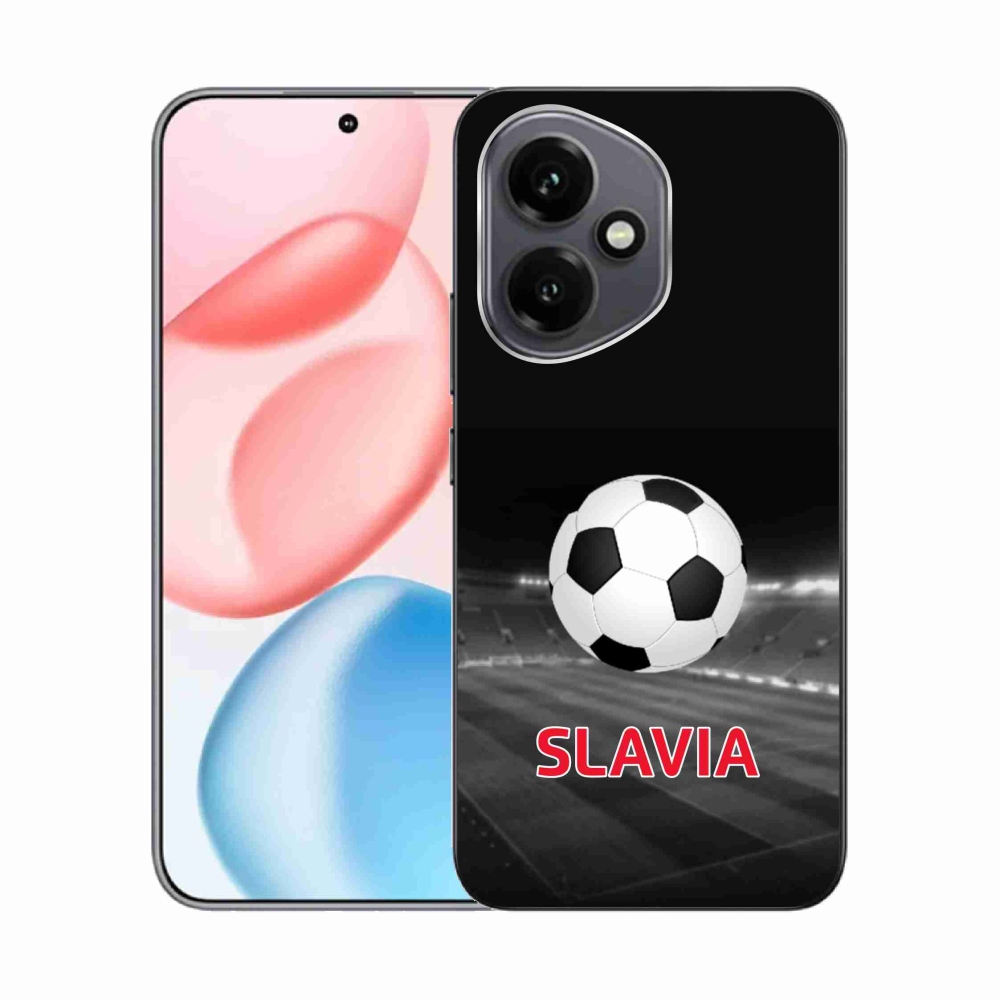 Zselés borítás mmCase a Honor 400-hoz - slavia