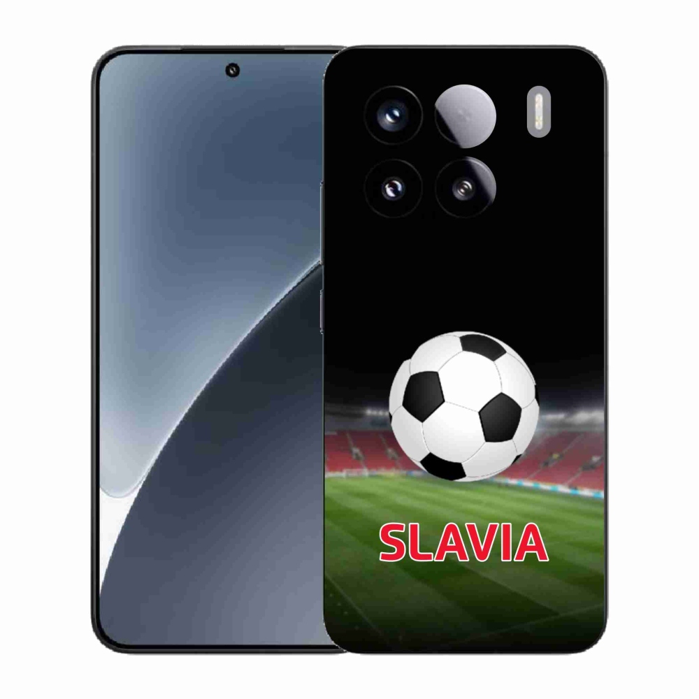 Gél borítás mmCase a Xiaomi 15 - slavia 1 számára